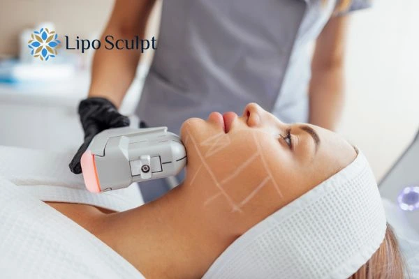 HIFU vs Botulinum Toxin: Understanding the Differences 1 HIFU vs Botox Far Coton What is the best option for you?