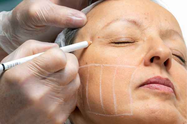 CryoPen: 5 Skin Concerns It May Be Used to Treat 4 What should you ask before having CryoPen treatment Far Coton?