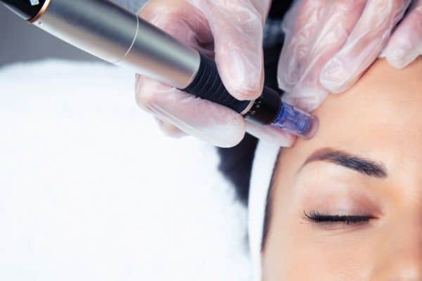 Explaining Total Skin Tightening Treatment and What to Expect 2 What Skin Concerns Can Total Skin Tightening Treatment Help With Far Coton?